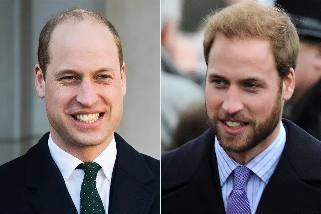 Prince William with and without beard