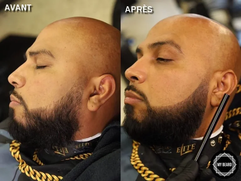 Lápiz de barba: resultados antes y después