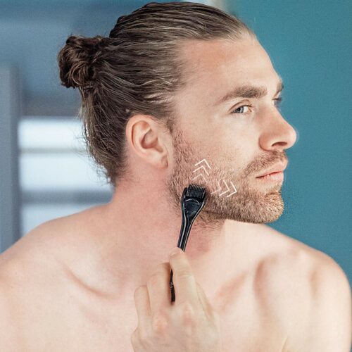 Aplicación del dermaroller en la barba