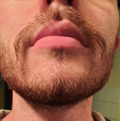 Barbe de 1 mois (2)