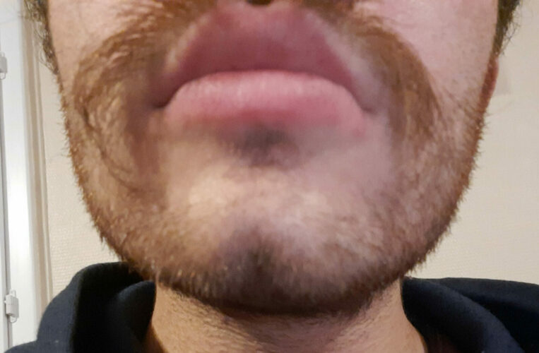 Barba de 10 días