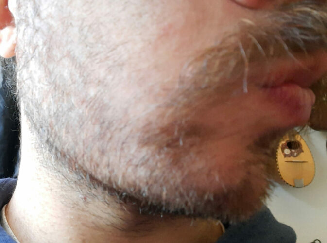 15 day beard