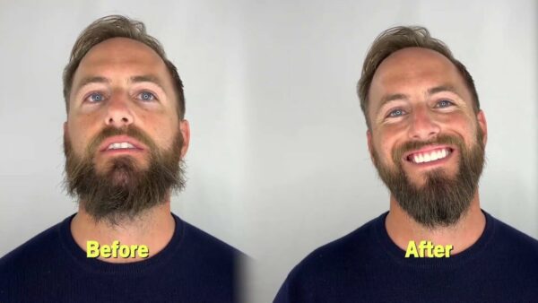 Resultado eficaz del alisado de barba